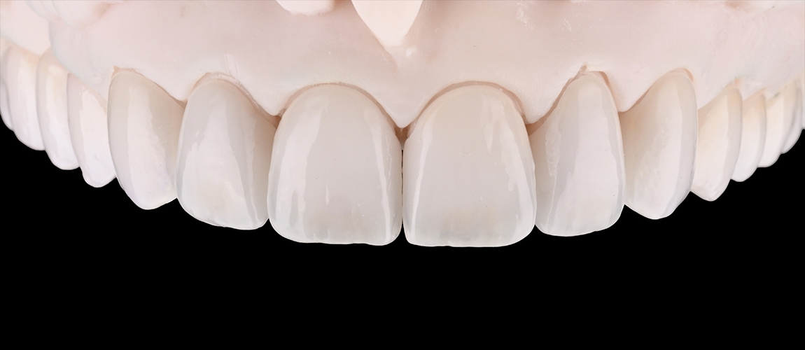 Model of flawless row of upper teeth