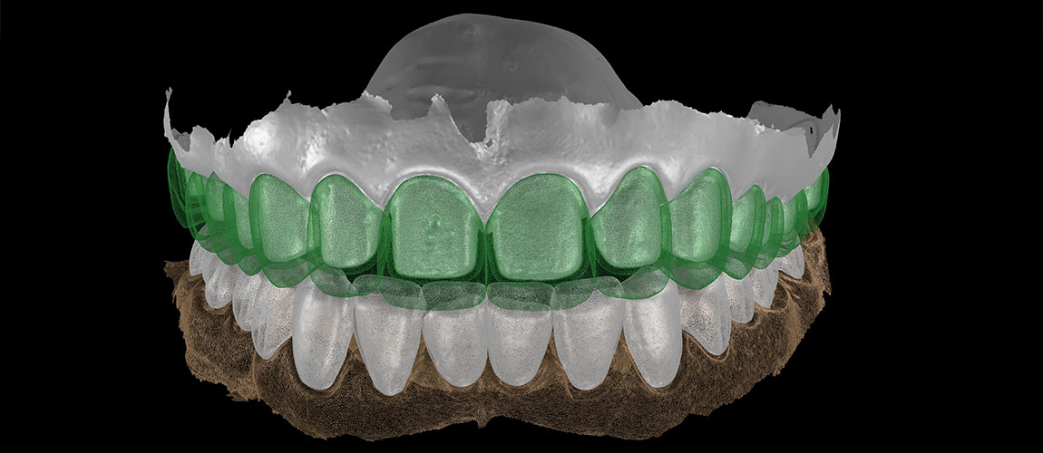 Digital model of two rows of teeth against black background