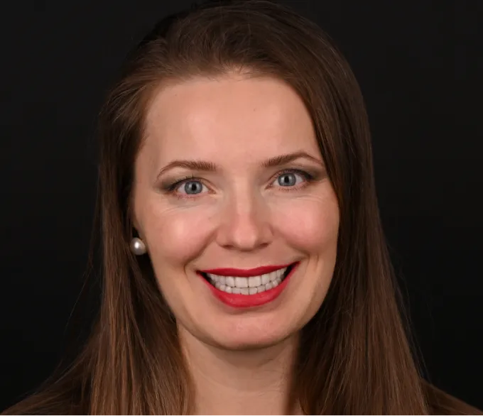 Brunette woman smiling with straight white teeth