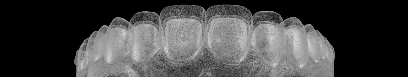Digital model of a lower row of teeth
