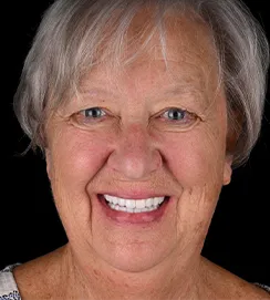 Senior woman smiling with flawless white teeth