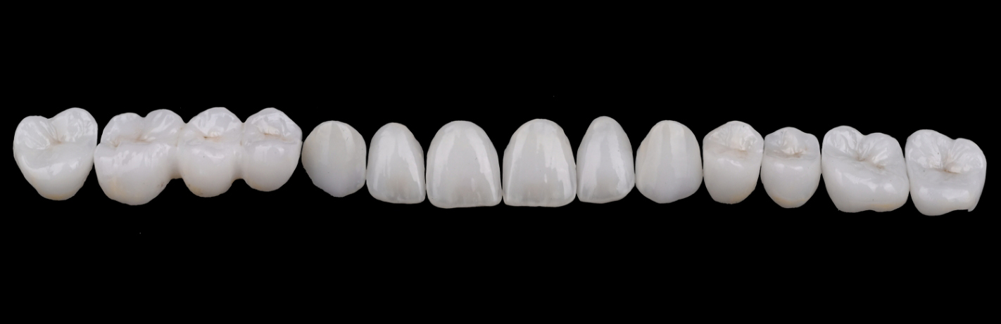 Several white metal free teeth against black background