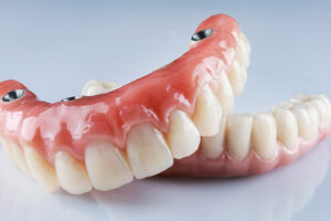A close-up of a pair of natural teeth with dentures placed on a white surface, highlighting dental restoration.